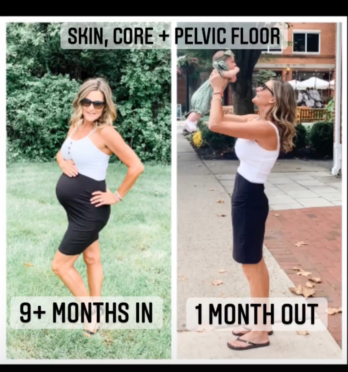 Before and after comparison showing Dr. Kimberly's postpartum recovery focusing on skin, core and pelvic floor strength